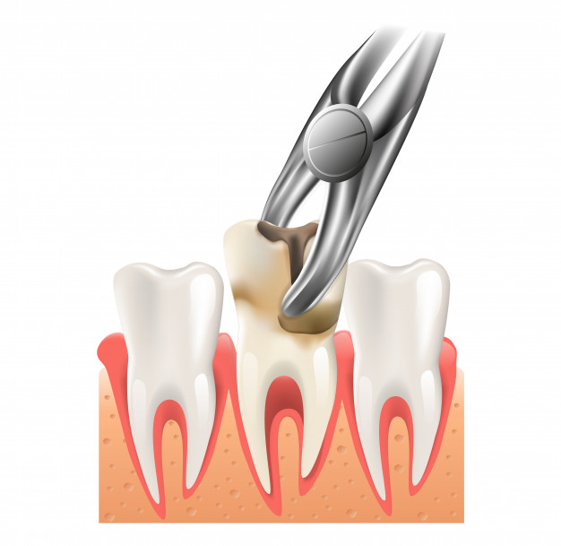 smile design